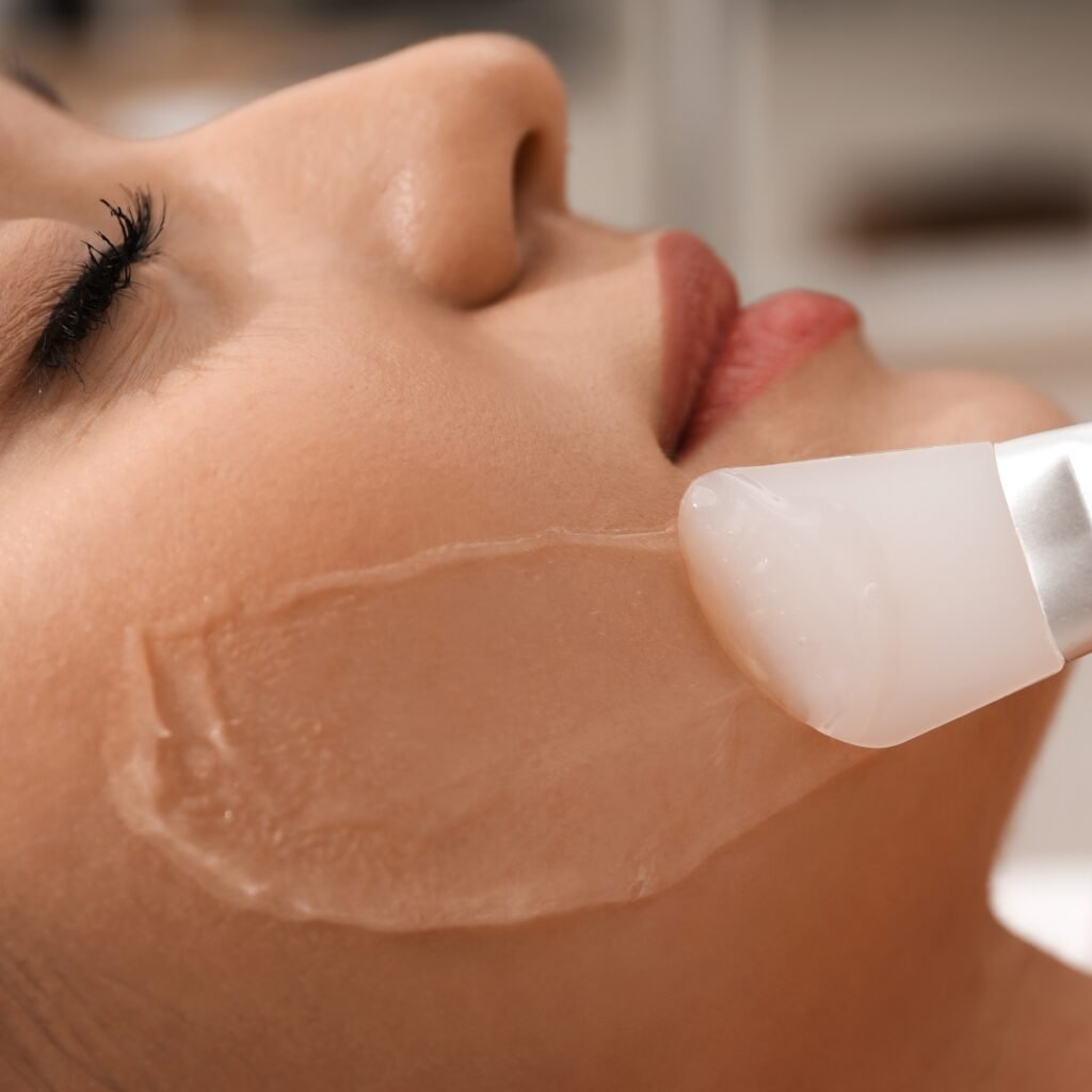 CHEMICAL PEELS: