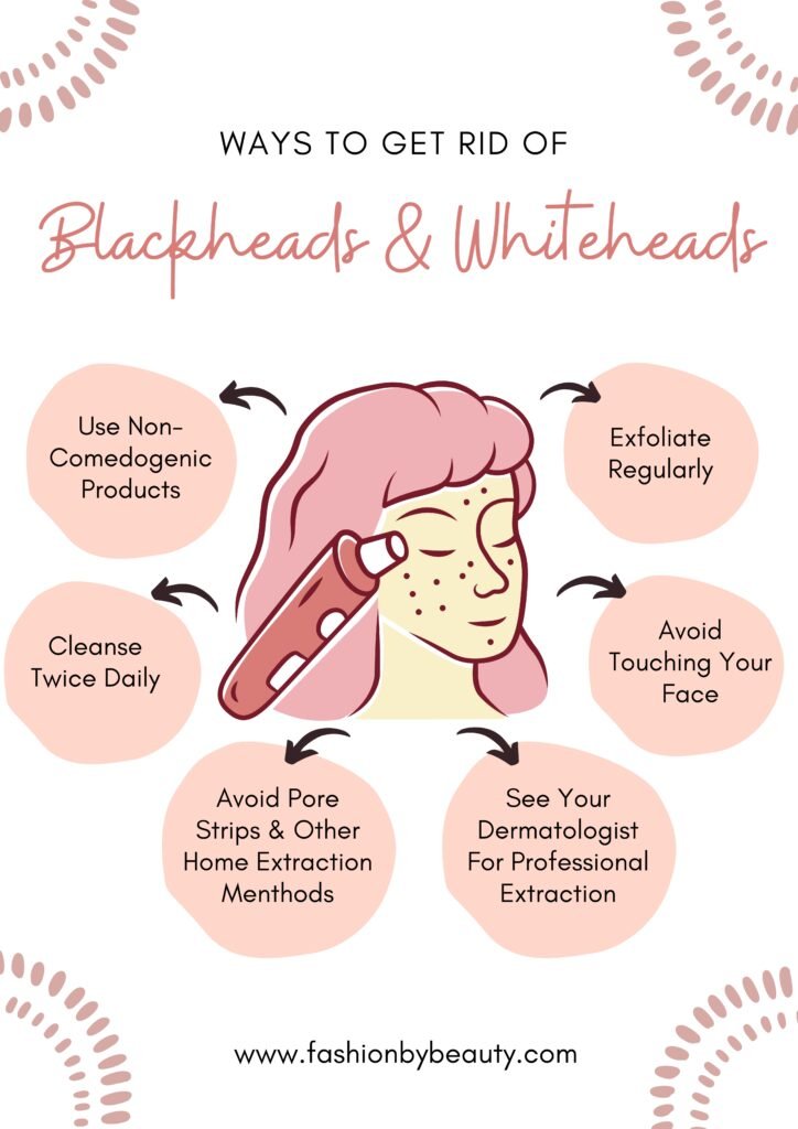 TIPS TO PREVENT BLACKHEADS AND WHITEHEADS: