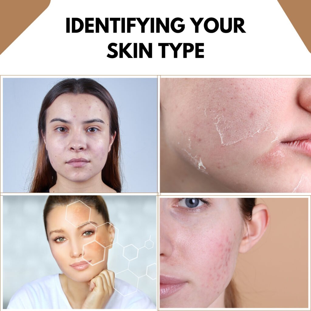 . IDENTIFYING YOUR SKIN TYPE: